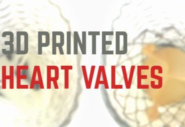 3D Printed Heart Valves