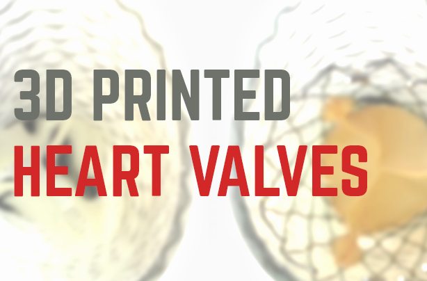 3D Printed Heart Valves