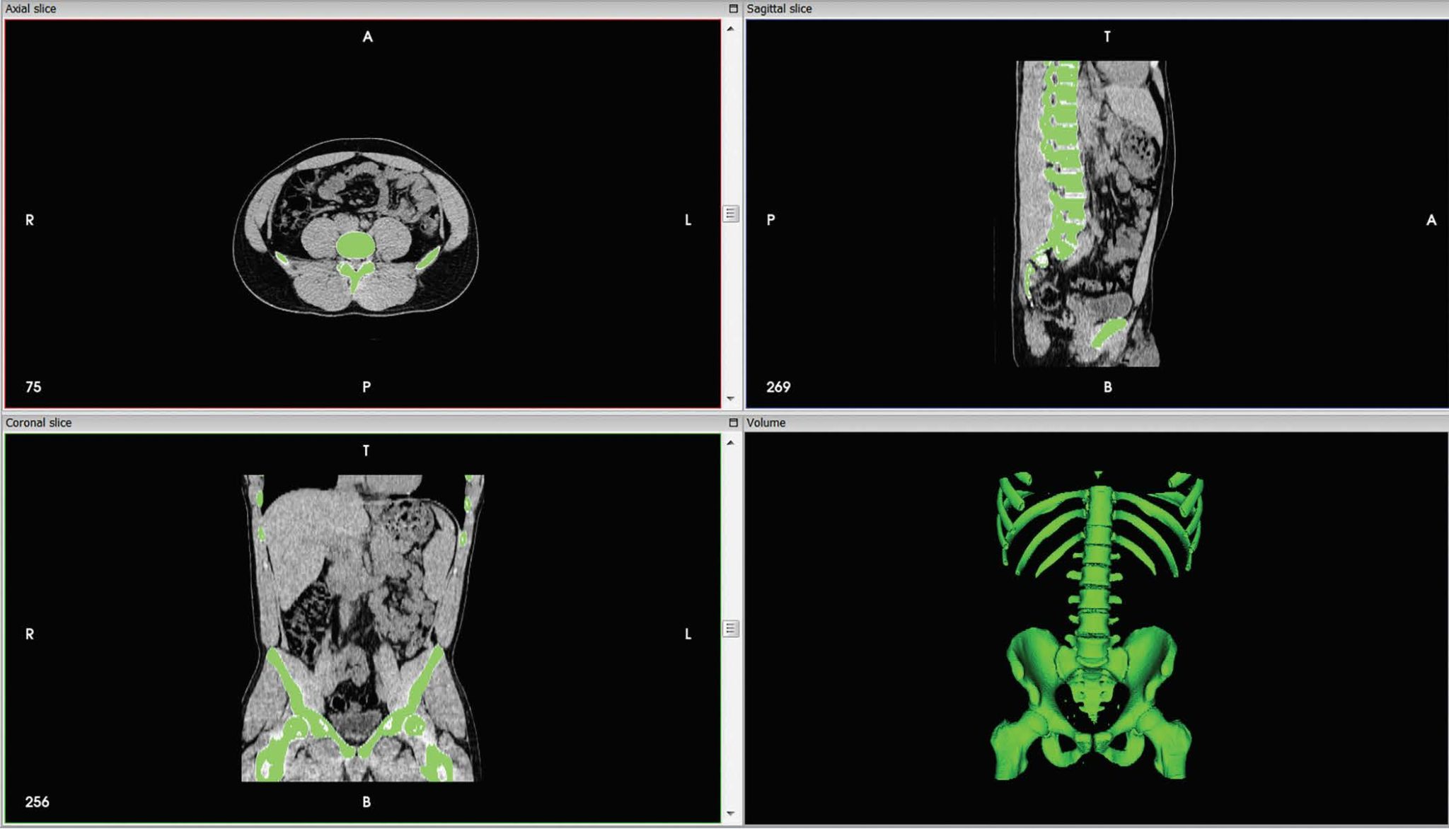 too many devices osirix md