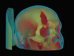 Data Segmentation for Medical 3D Printing 3