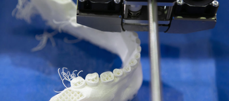 A close-up of 3D dental printing. See how 3D printing lowers costs and improves treatment
