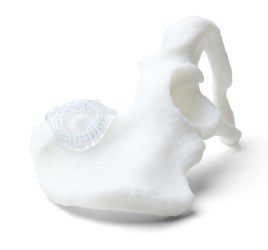 Image shows bone with medical part 3D printed wiith BioMed Durable resin from Formlabs