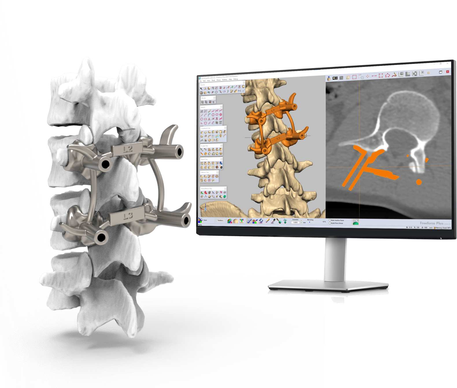 Image of a rendering with human spine rendering designed in FreeForm Geomagic software